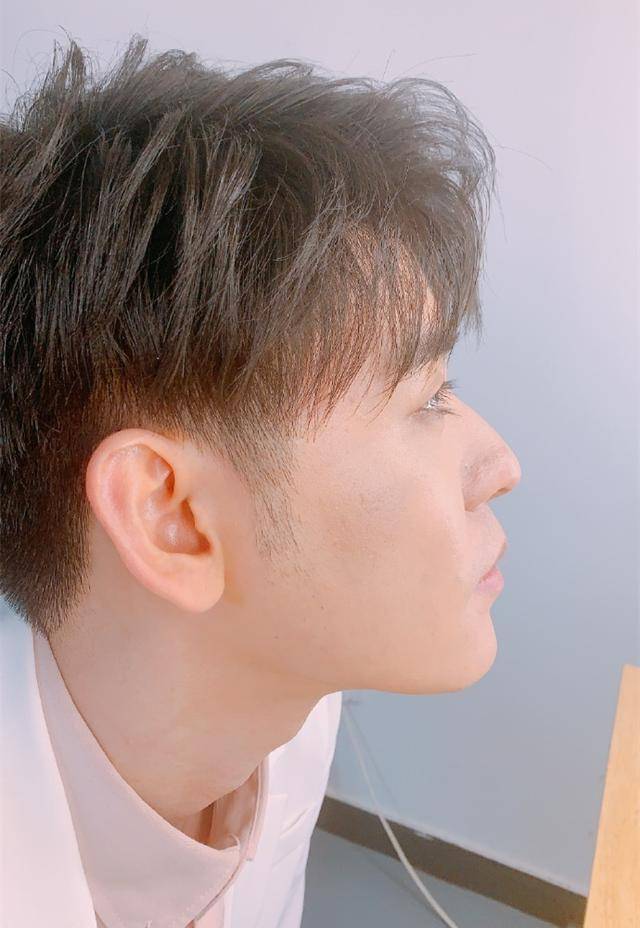 德云社张云雷晒自拍照,新发型引发大家期待,粉底:到底有多短呢_柠檬