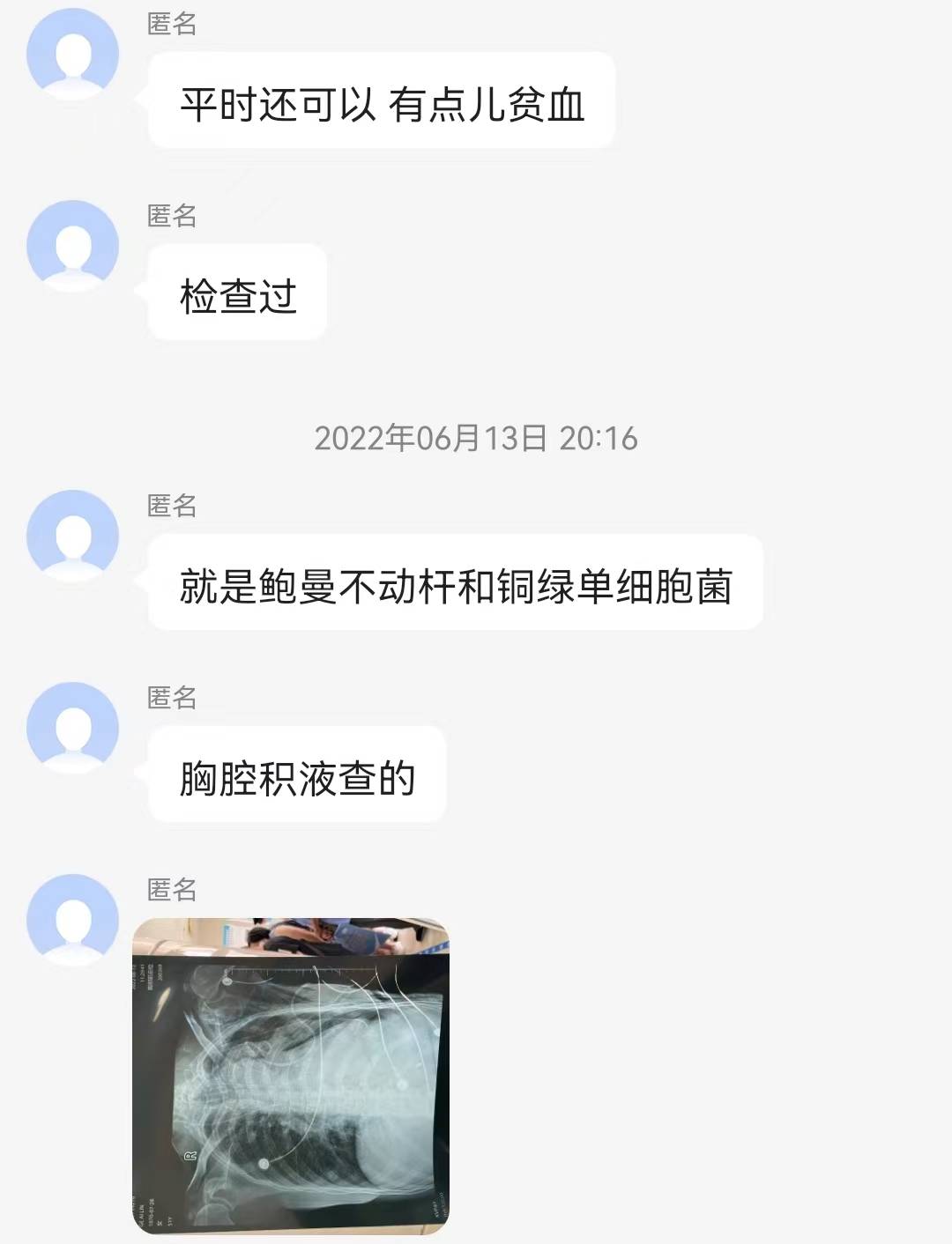 51岁女性发烧咳嗽一天住进ICU，一查半边肺没了，检出一窝耐药菌