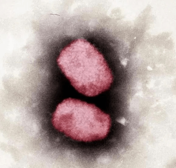 狐大医 | 感染猴痘会有致命风险吗？如何预防？专家详解