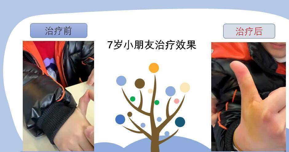 7岁小朋友治疗前后对比唐流刚表示,这种中医的适宜技