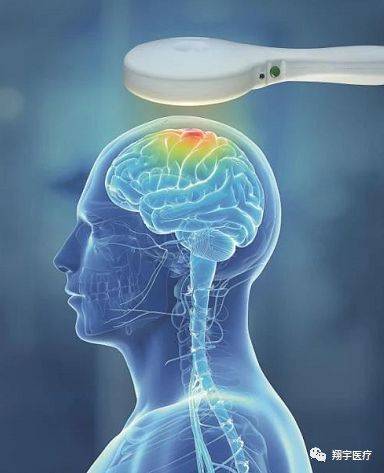 经颅磁刺激器星与心愿