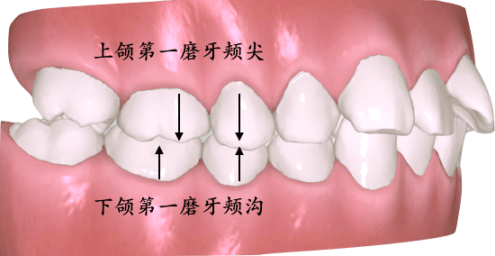 牙齿远中近中示意图图片