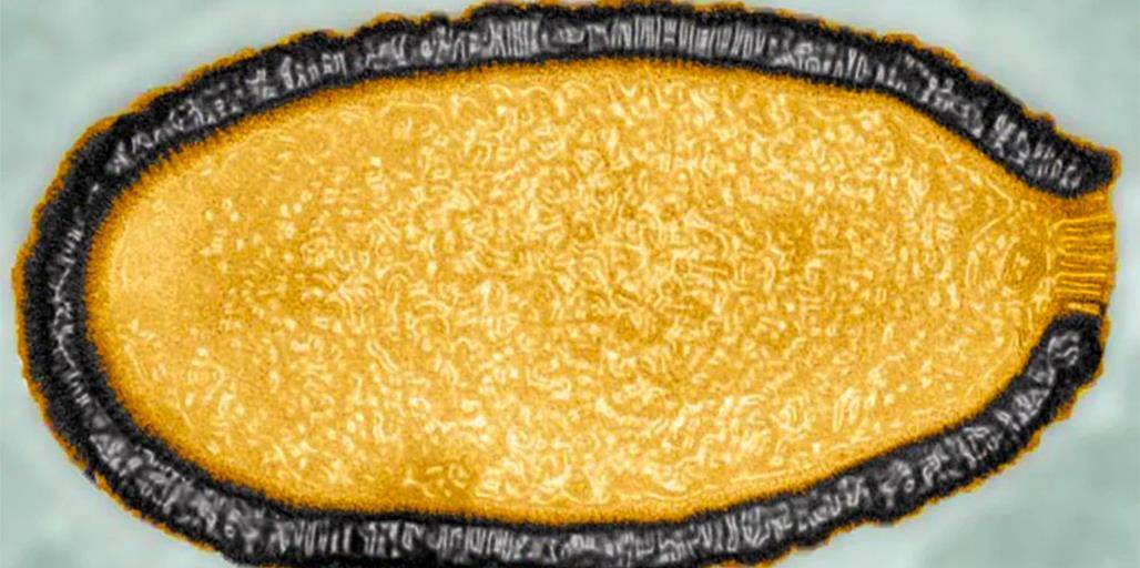 阔口罐病毒是目前为止,全球已经发现的最大病毒.