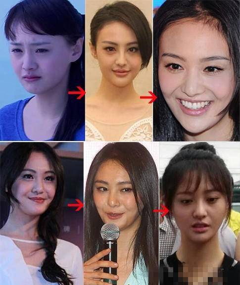 如此高的起点,却不曾想她似乎并没有什么"事业心",为了张翰不惜去整容