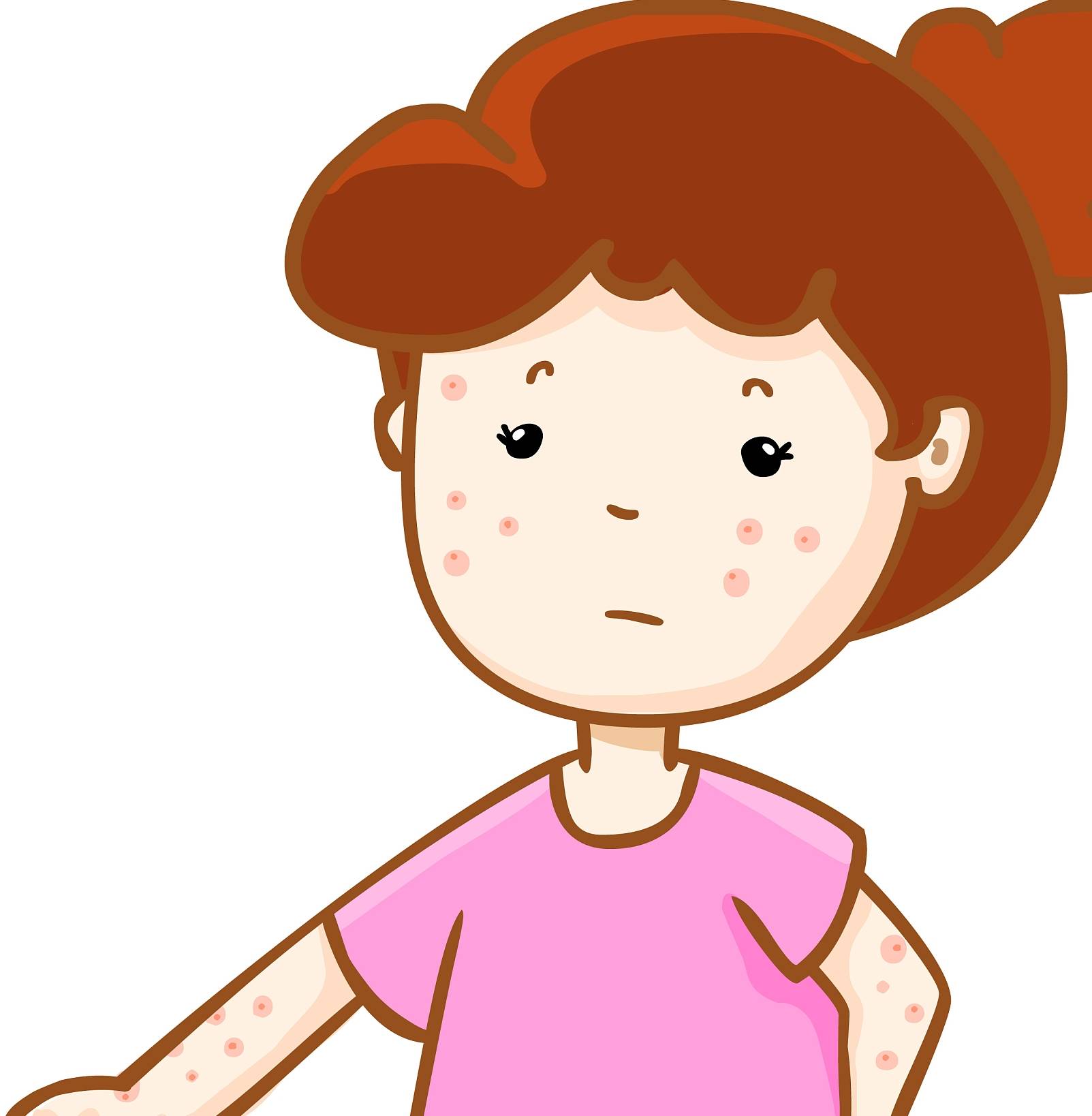 宝宝湿疹,到底该保湿,还是保持皮肤干燥?_肠道_杆菌_研究