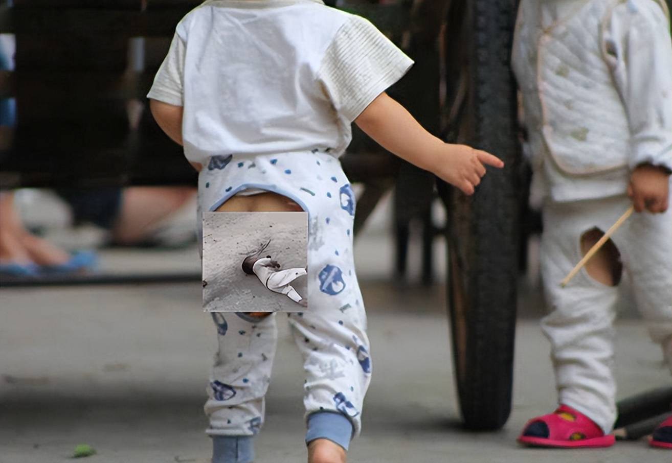 夏天给孩子穿开裆裤只图凉爽却忽略弊端怎样穿才不坑娃