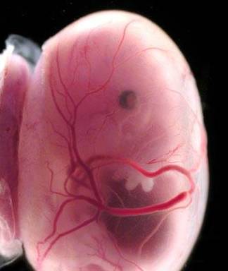 异形胚胎图片