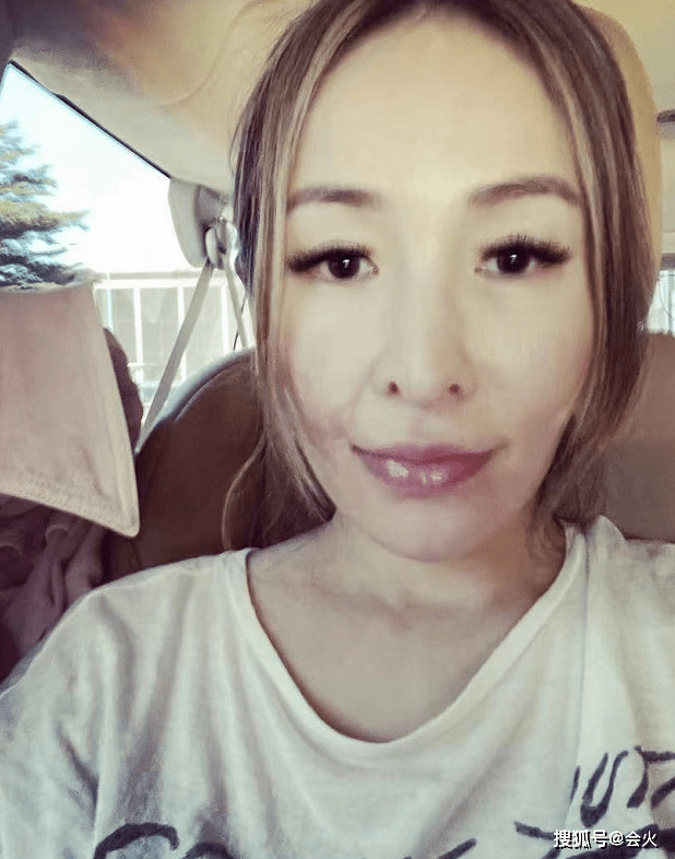 萧亚轩被狗咬后素颜晒疤!下巴布满增生伤痕