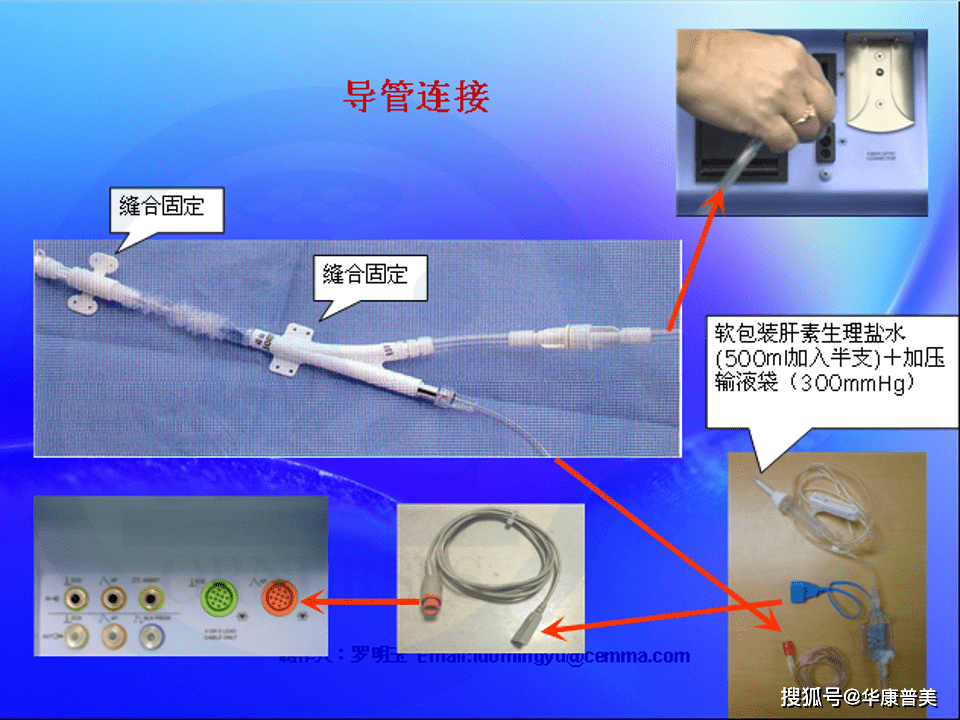 迷你中长导管PPT图片