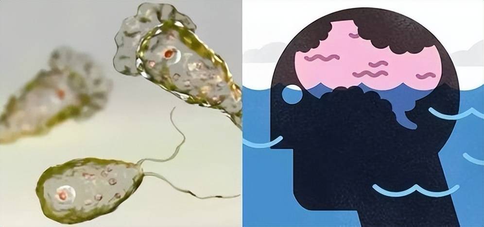 原创能吃人脑子致死率97美国再现食脑变形虫中国有吗