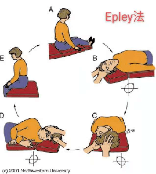 无需担心,治疗很简单!_眩晕_位置_前庭