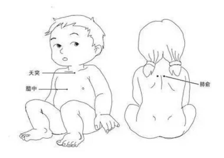 今日入伏,冬病夏治就这一次,错过再等一年(视频版三伏贴使用攻略)