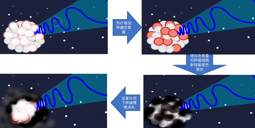 热疗登上热搜无创无痛无毒的肿瘤热疗新技术你了解吗