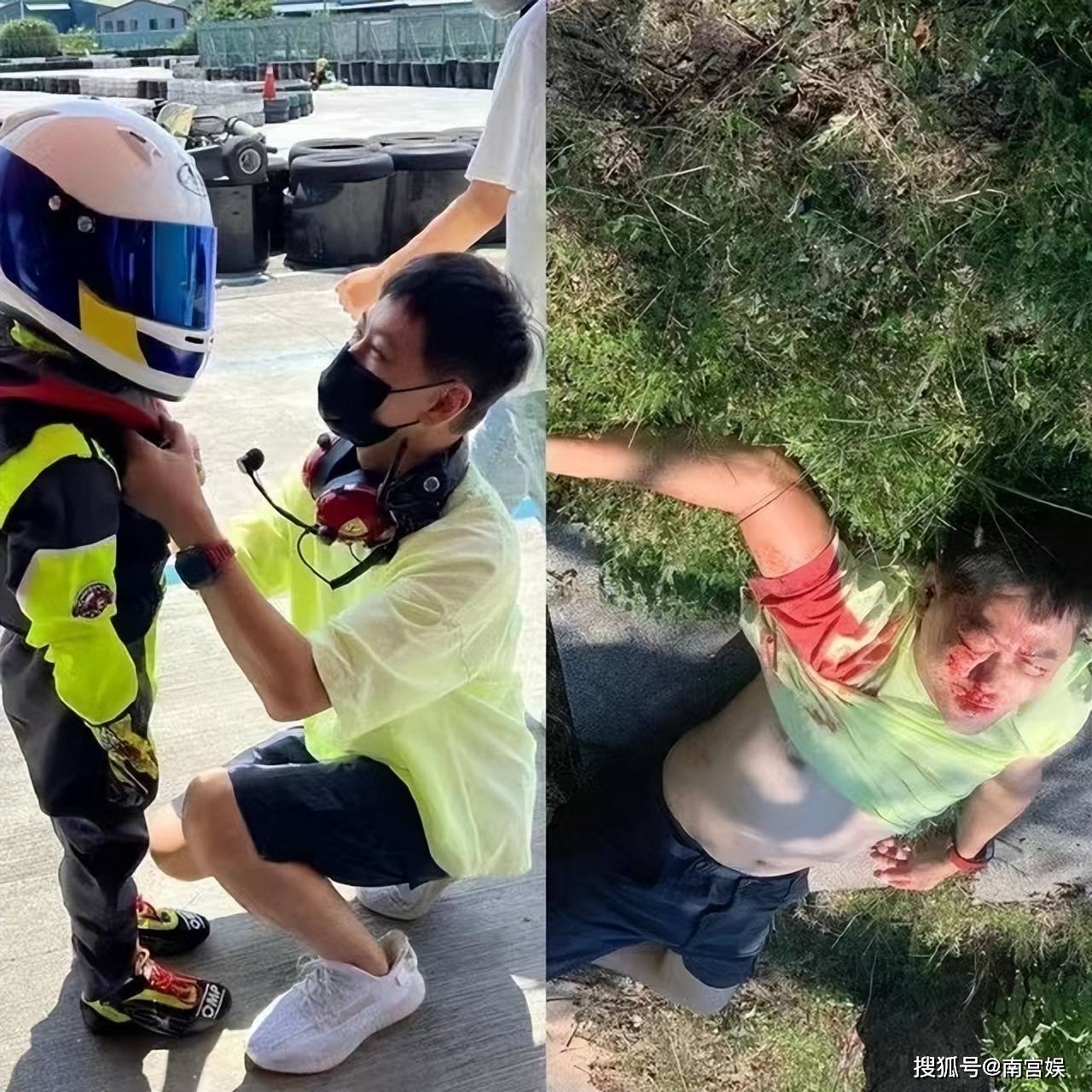 原创林志颖车祸伤势严重住院胳膊不正常扭曲颜面肱骨有骨折要手术