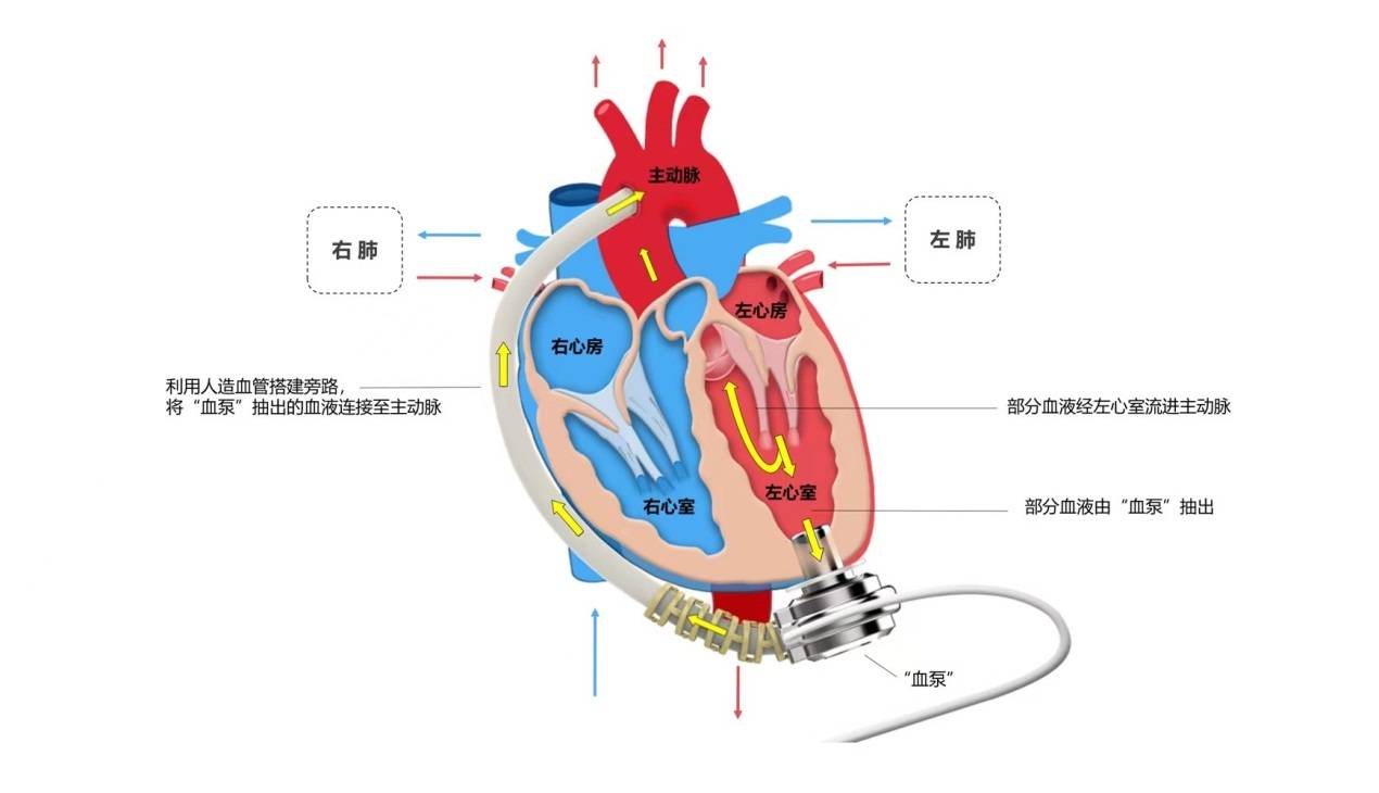 心脏射血动画图片