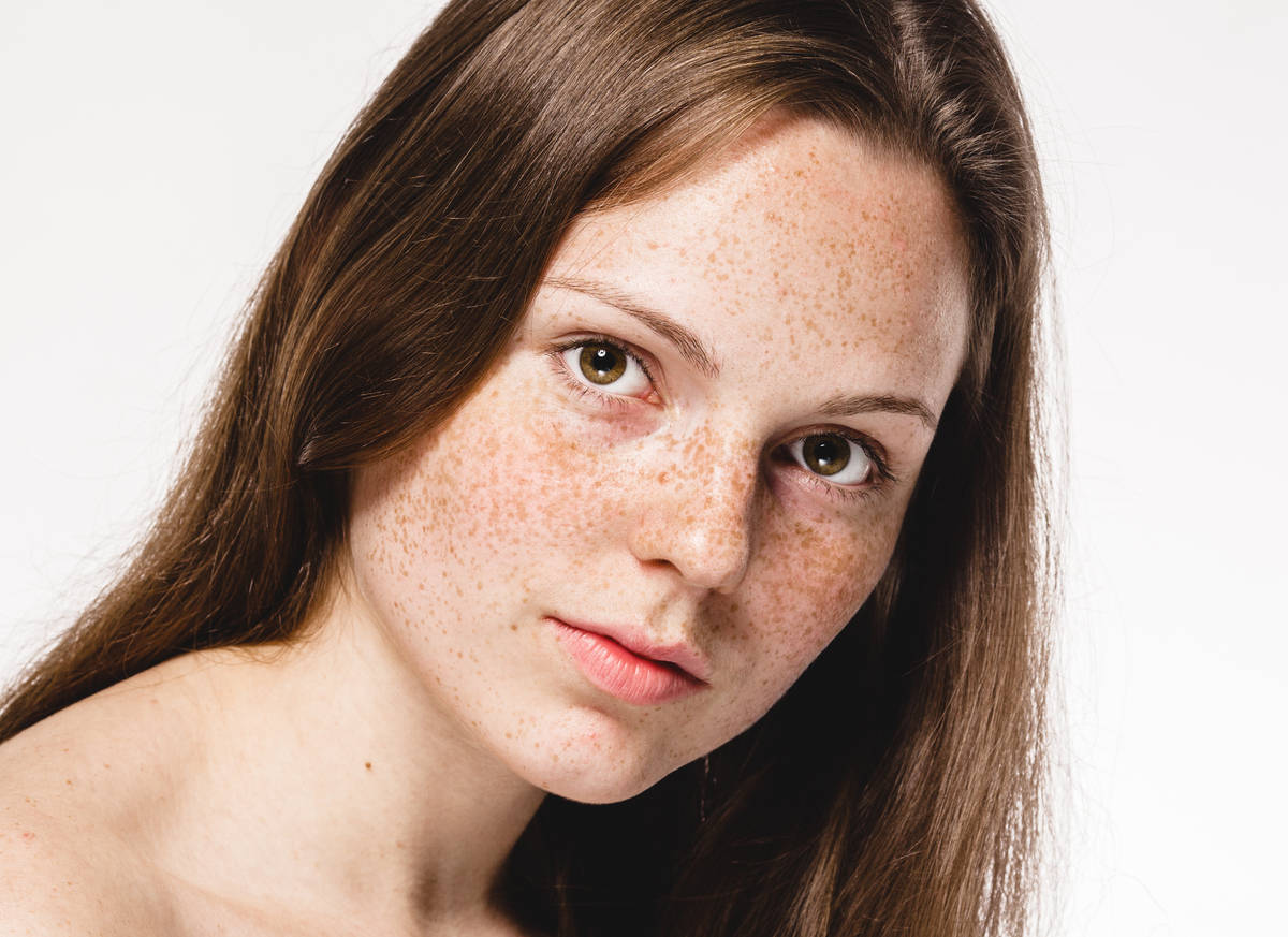 长斑毁所有这些长斑原因不可忽视