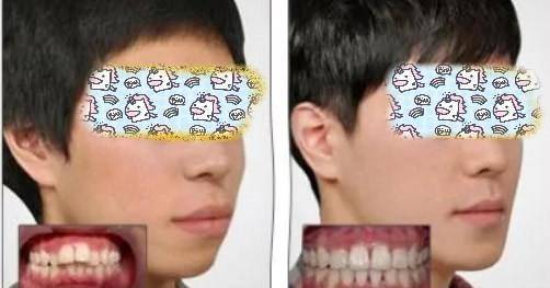 原创同样是凸嘴为什么这些女明星就这么漂亮两招教你摆脱土气脸