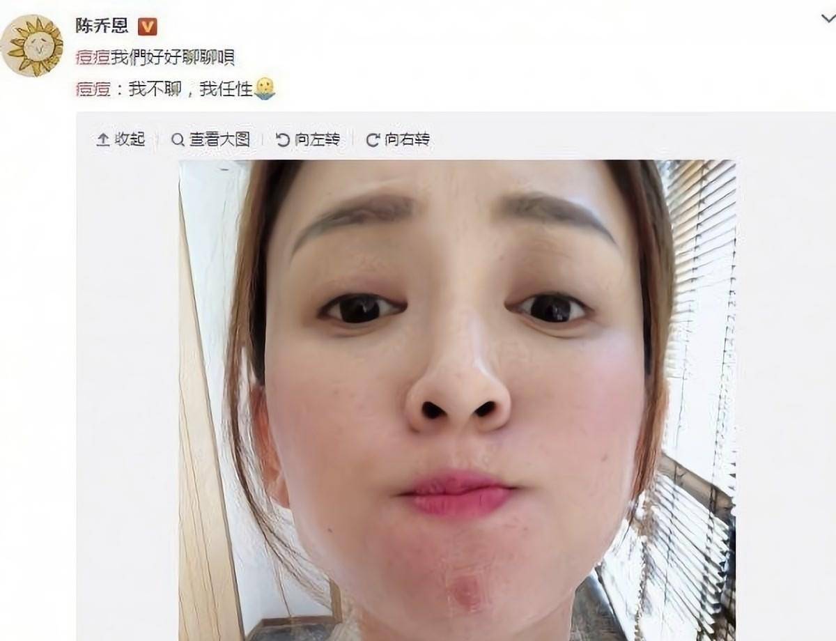 女明星长痘痘的时候也喜欢晒太阳,乔欣说她有乞丐的皮肤,刘涛遮不住她