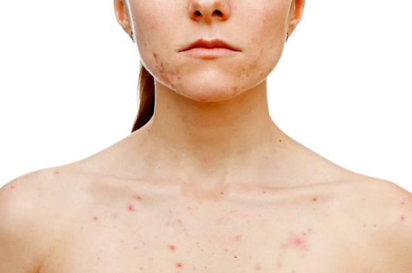 肝怕"3白",要少吃,肝喜"2黄,"要多吃,养肝就