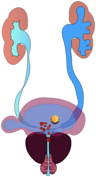 肾脏产生尿液后由输尿管运送至膀胱,膀胱储存一定尿液后由尿道排出.