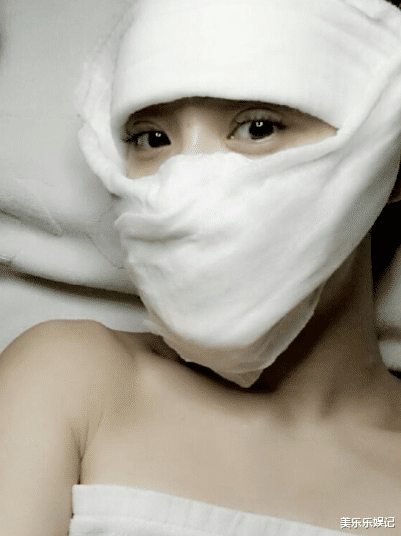 想再辩解了,姚芊羽曾在自己的社交平台上晒出一张满脸包满纱布的照片