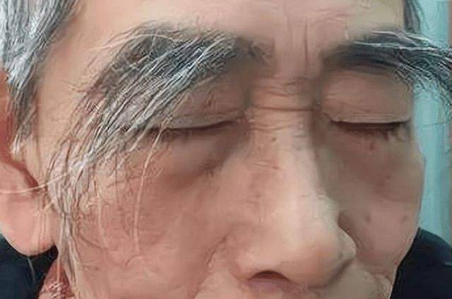 眉毛白又怎样_老年人_头发_情况