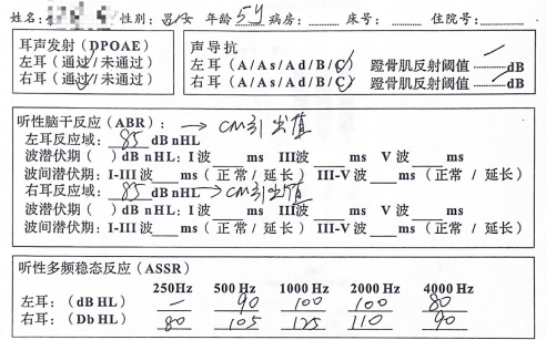 abr,assr03dpoae双耳均通过耳声发射02听力曲线呈上升型平均听阈:左耳