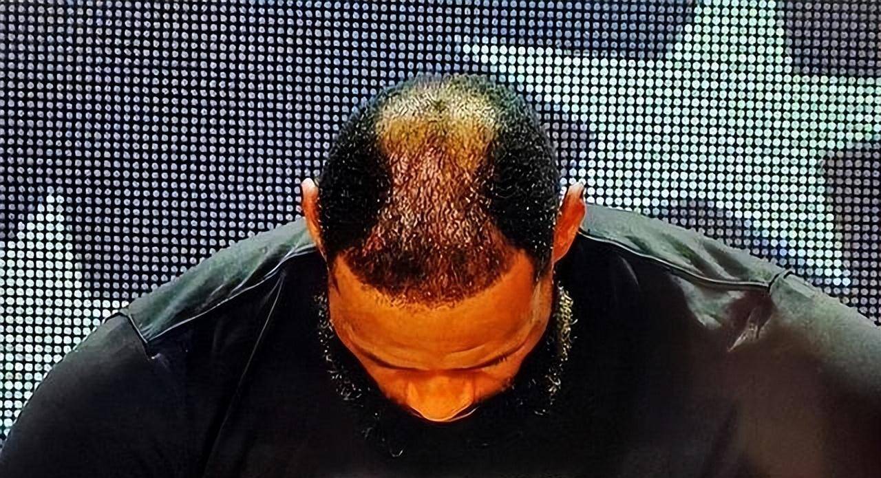 有球迷建议杜兰特,头发都已经快掉光了,还不如直接剃光,像乔丹和科比