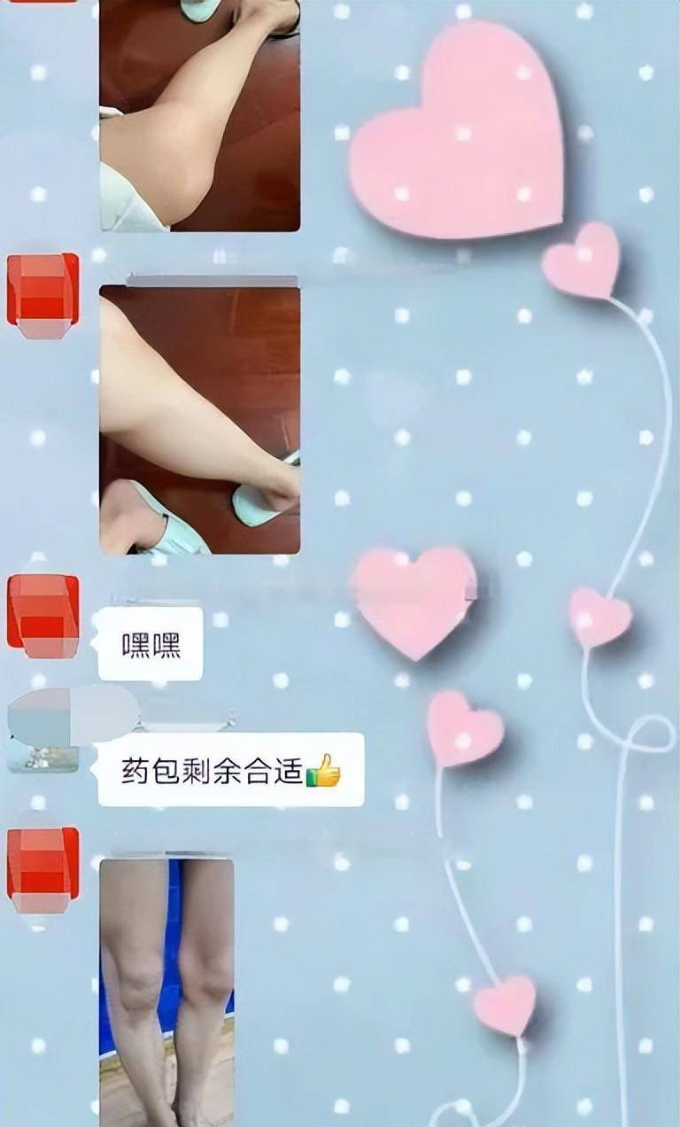 鸡皮肤和鱼鳞病一样(鱼鳞病和鸡皮肤区别图片) 鸡皮肤和鱼鳞病一样(鱼鳞病和鸡皮肤区别图片)