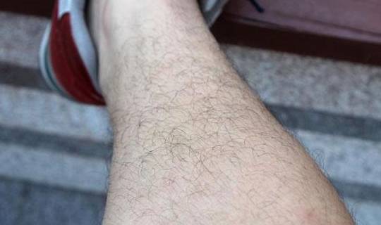 是什么决定了体毛的多少?_男性_进行_毛发