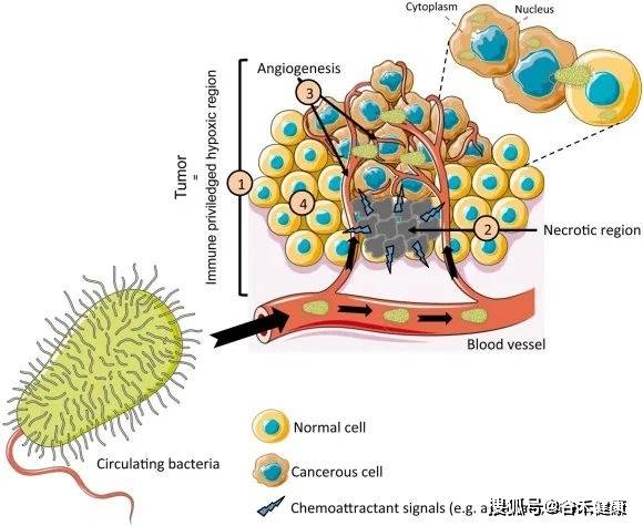 肿瘤内微生物群在癌症转移中的新作用_癌细胞_组织_进展