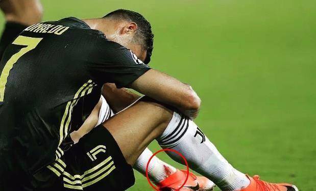 c罗遭狂嘘滚蛋 小球迷竖中指拼到脚踝渗血无人知_尤文_染红_瓦伦西亚