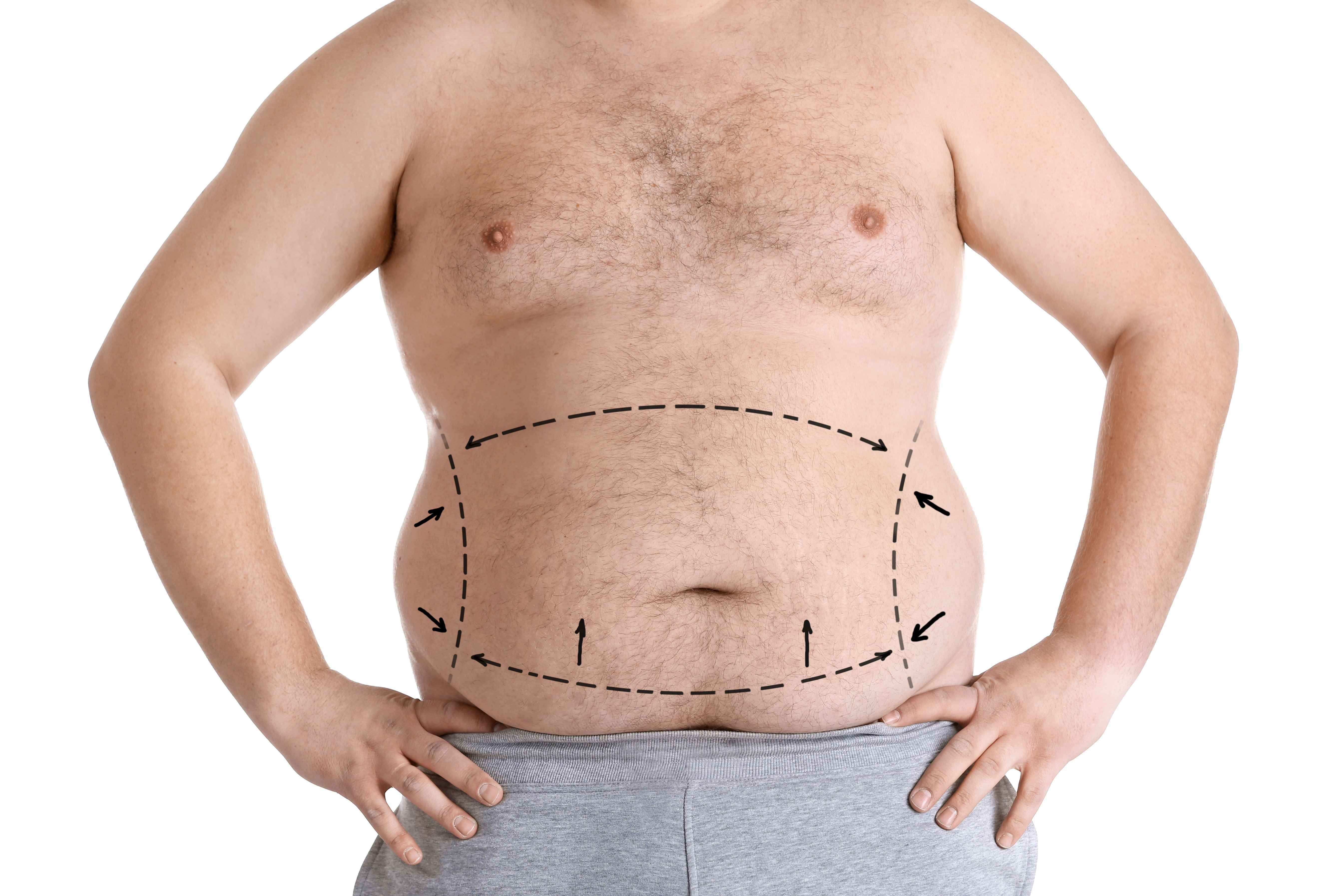 胖先胖肚,减肥先减胸？网传所谓的局部减肥,真的能瘦肚子吗？