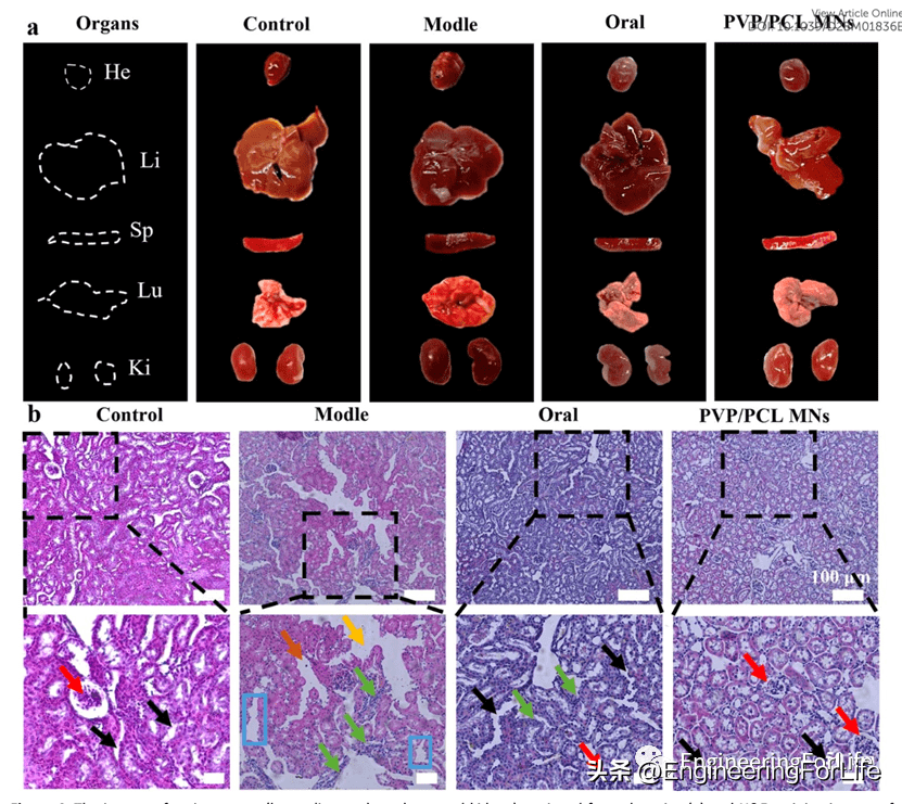 治疗结束后,取下小鼠心脏,肝脏,脾脏,肺和肾脏组织.