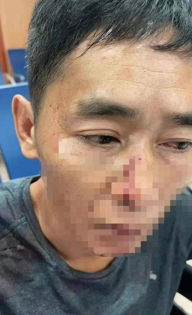 《莲花楼》代拍男子被打鼻子出血,剧组宣布开除打人者_人员_视频_体型