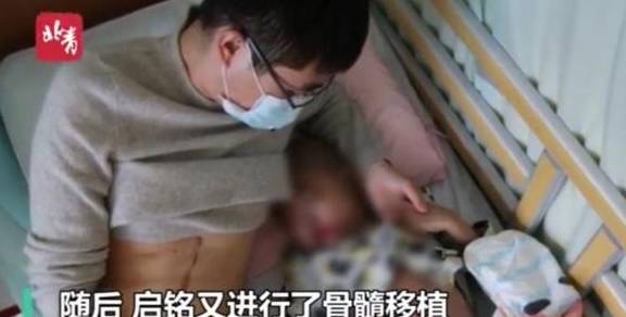 河北父亲割肝救儿子，5岁孩子：你们再生一个，不要为我花钱了