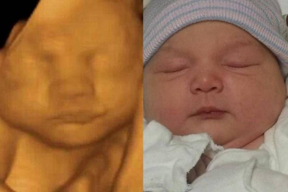 新生儿出生之后的样子为什么和四维图有所差异 产检有哪些好处