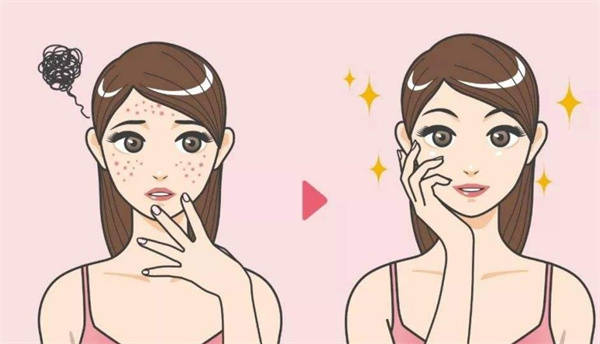 以前我的脸上是干干净净的,结婚后没几年就开始长斑了,非常的烦恼