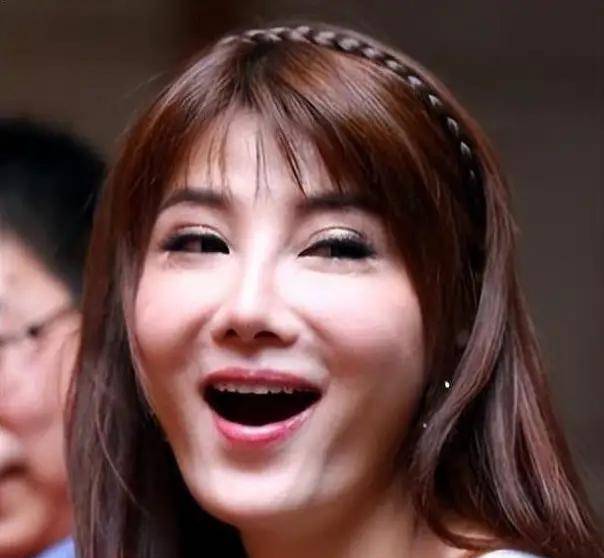 满脸玻尿酸,面部僵硬似蜡人,这些明星宁愿"毁容"也不愿意变老_影响