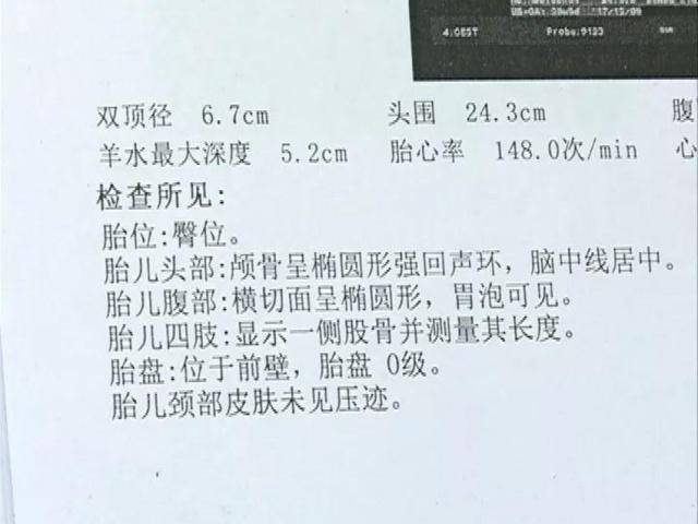 学到了吗（整蛊怀孕b超单图）怀孕b超单生成软件 第3张