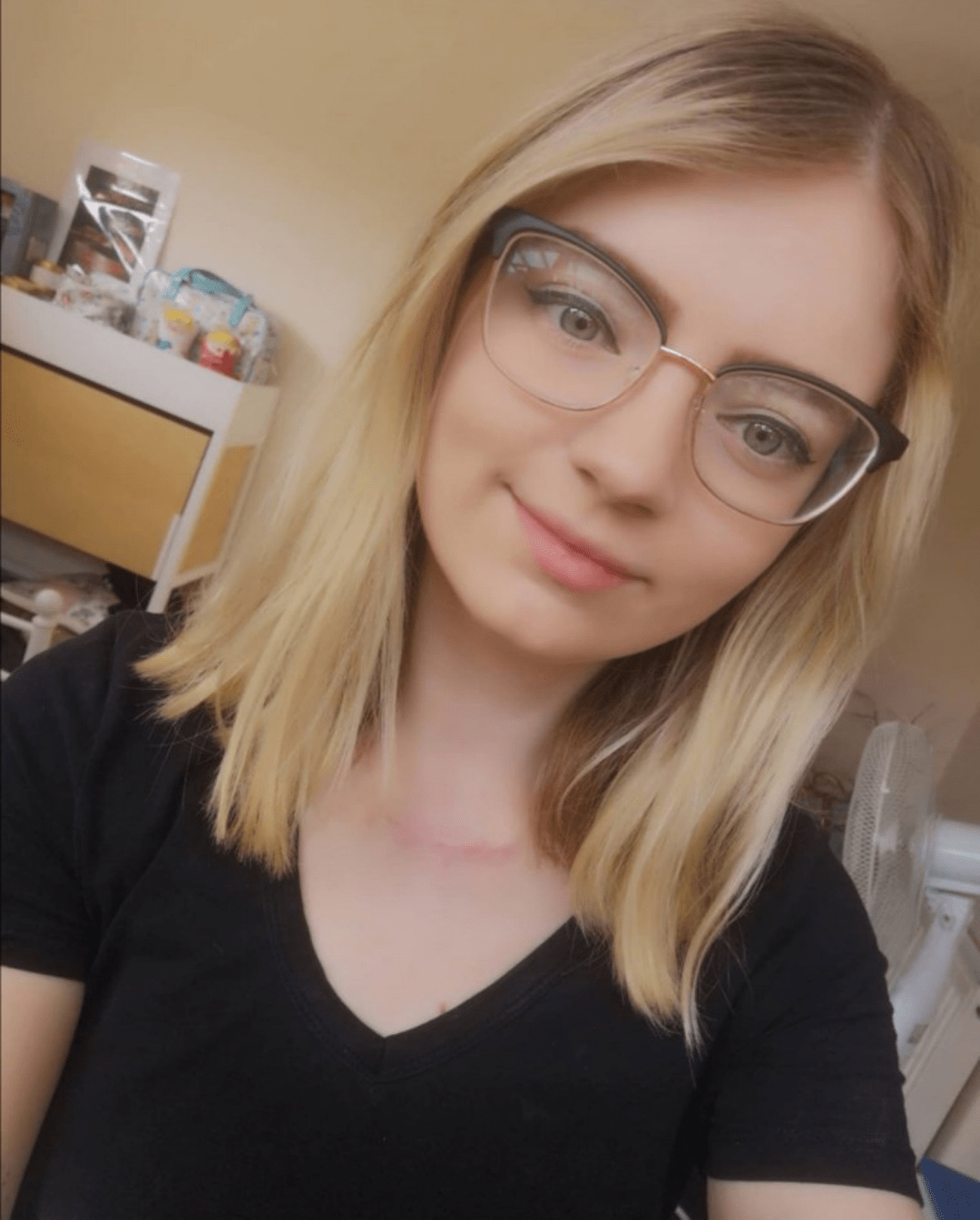 21 岁时被诊断出患有黑色素瘤的女性脖子上的痣突然开始发生变化_shaw