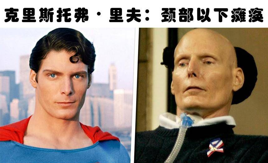 christopherreeve:颈部以下瘫痪著名的好莱坞喜剧演员金凯瑞在很小的