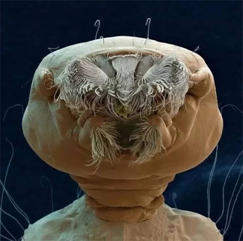 孩子既然有兴趣,那就带他看看,肉眼不可见,镜下大怪兽的细菌显微镜下