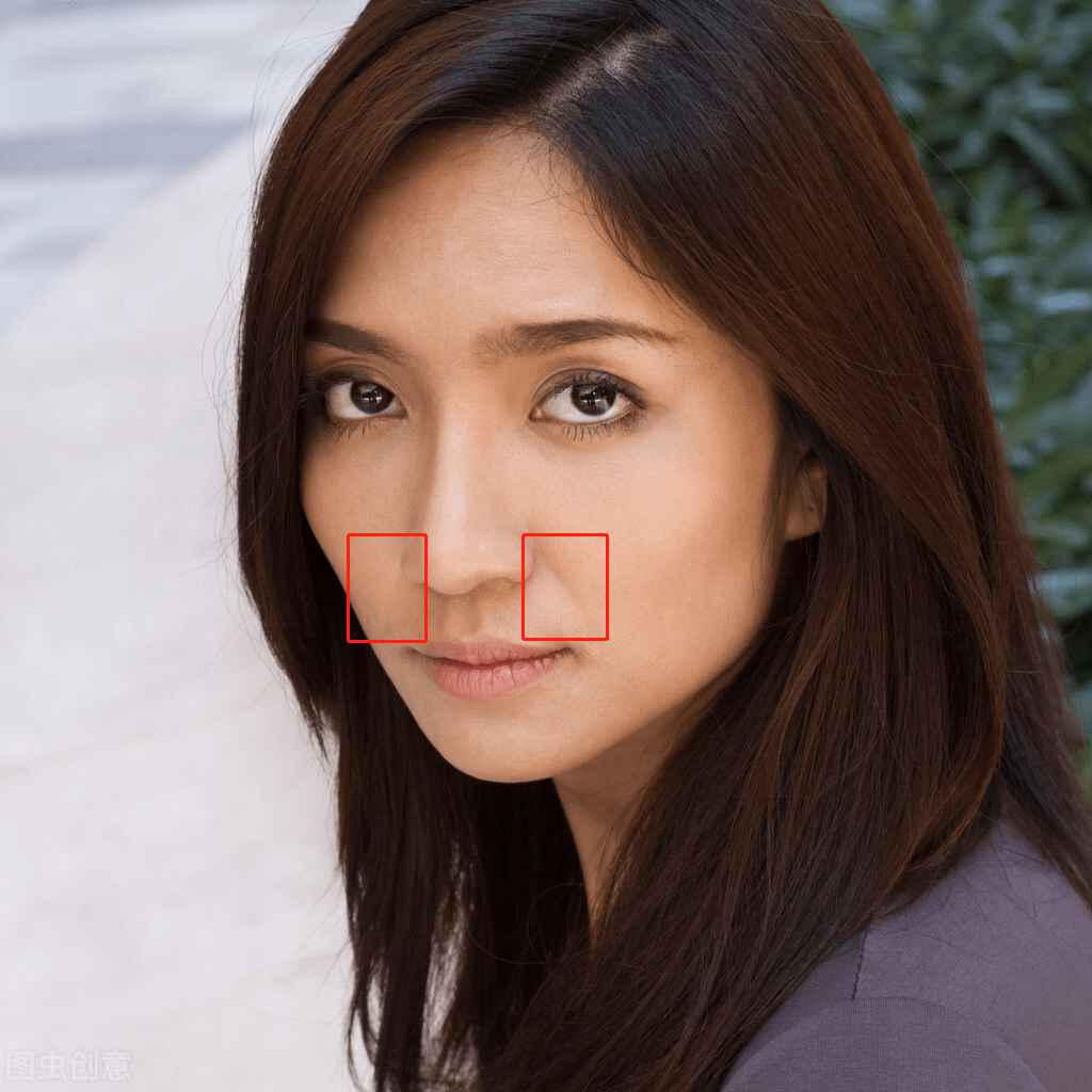 面中凹陷,嘴凸,法令纹深?你可能是鼻基底凹陷了_问题_面部_脂肪