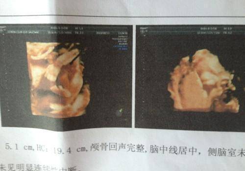 快来看（恶搞怀孕彩超图片）b超图片怀孕恶搞通知生成软件 第3张