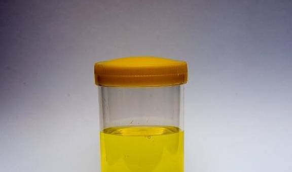 尿液"发黄"是上火的表现?不一定,可能与这4件事有关!