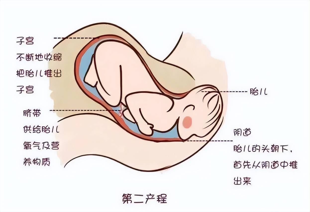 分娩镇痛会抑制宫缩