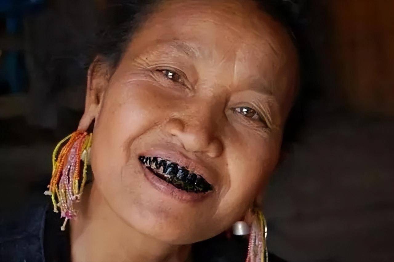 所以为了自己的身体健康,槟榔还是能少嚼就少嚼,当然不嚼最好.