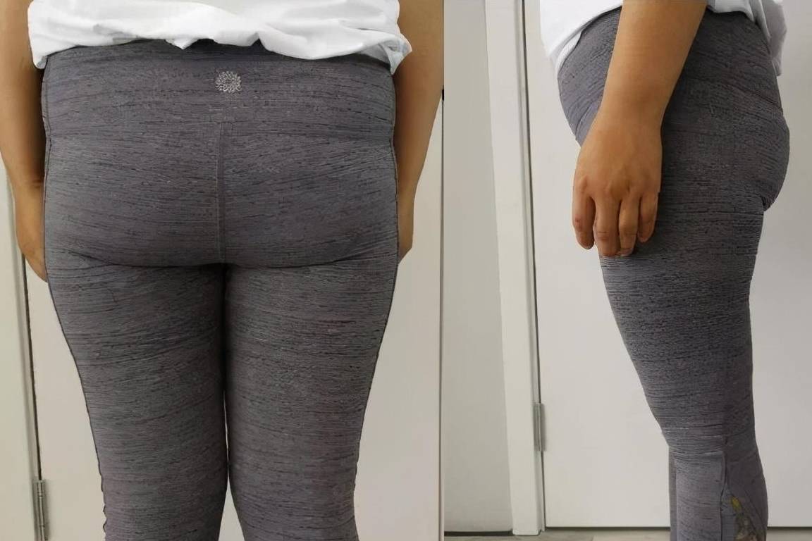 产后妈妈臀,大腿前侧外凸脂肪厚?一个姿势帮你改善_肌肉_关节_力量