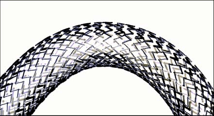 niti镍钛合金血管植入物的功能与性能:血管支架,封堵器_应变_应力